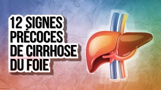 12 signes précoces de cirrhose de foie