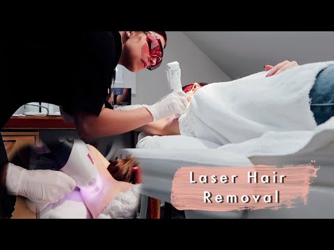 My honest experience getting laser hair removal for the first time! Painless and Safe???