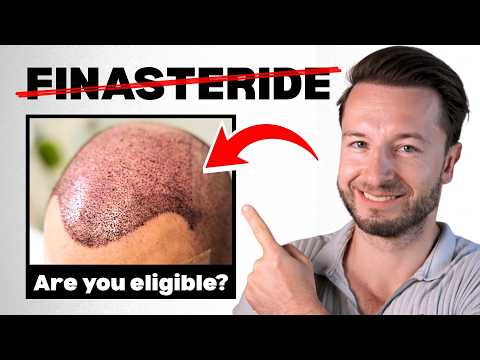 Hair Transplant Without Finasteride: 3 Times It Can Work!