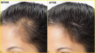 How To Apply Vitamin E On Hair Videos Kansas City Comic Con