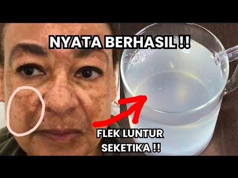PALING AMPUH!! PELUNTUR SEMUA JENIS PLEK HITAM YANG SUDAH MENAHUN & BARU!!