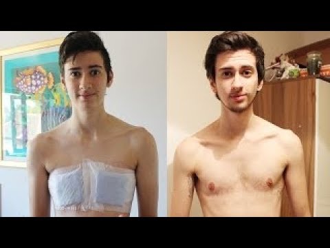 بعد 7 سنوات زواج يكتشف ان زوجته رجل "شاهد ماذا فعل بها امام الناس" !!