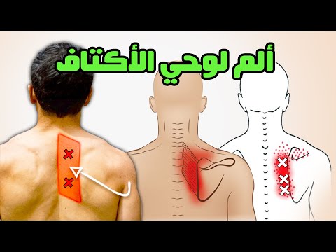 تخلص من ألم الطعن المزعج بين لوحي الكتف والعمود الفقري في غضون 10 دقائق فقط