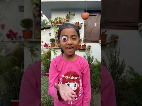 Ashna eyes turn gummy candy 😱🤣🤣 comedy #shorts #funny #reels #newreels #viralvideo
