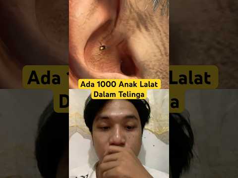 Ada Lalat Dalam Telinga‼️ #facts #animals #didyouknow