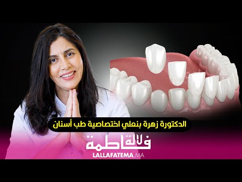 ماهي "les facettes » ومن هم المرضى الذين يحتاجونها  ؟
