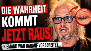 Robert Geiss: Dieser Eingriff schockt alle!