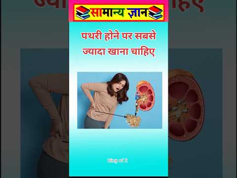 पथरी होने पर सबसे ज्यादा #viral #facts #videos