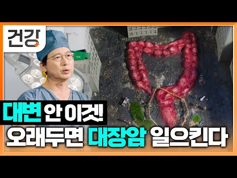 대변 안의 발암물질 오래 정체될수록 대장암, 직장암 발병률 높인다? | 변비가 무서운 이유 | 명의 | EBS 건강