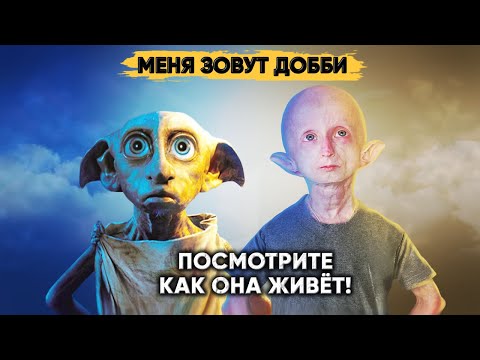 ДОББИ В РЕАЛЬНОЙ ЖИЗНИ. Удивительная история девочки из Сибири.