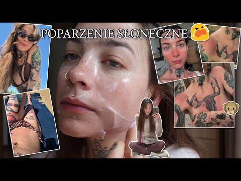 POPARZENIE SŁONECZNE I DRAMA Z KURIEREM - VLOG