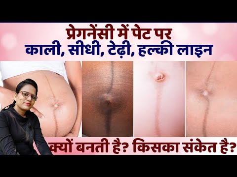 Nabhi Line se kaise pata kare Ladka hai ya Ladki | Baby Boy Prediction in Pregnancy | Gender Predict
