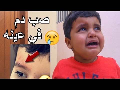 اخوي الصغير يبكي لان فيه احد ضربه 😭😭!!