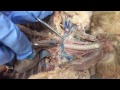 Functions and Anatomy of Major Blood Vessels