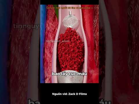 Dọn dẹp mạch máu.