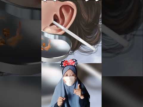 Lebah Diam -diam masuk Telinga |Mv #shorts