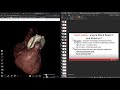 Heart Valves and Their Functions