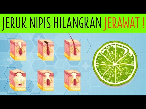 3 CARA TERBAIK HILANGKAN JERAWAT DENGAN JERUK NIPIS!