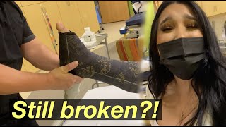 GETTING MY LEG CAST REMOVED!! (SO EXCITED) *MUST WATCH*
