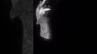 CRAZY - OUT NOW #crazy #future #music