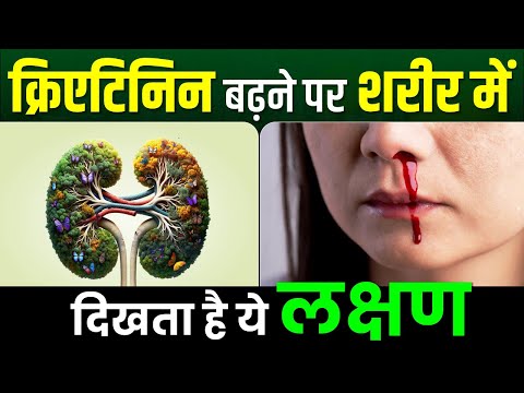 क्रिएटिनिन बढ़ने पर शरीर में दिखता है ये लक्षण | Symptoms of High Creatinine | Karma Ayurveda