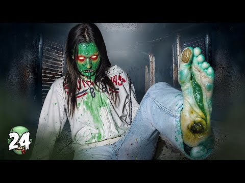 La Chica ZOMBIE Tiene INFECTADO el PIE! *Huele mal🤢*