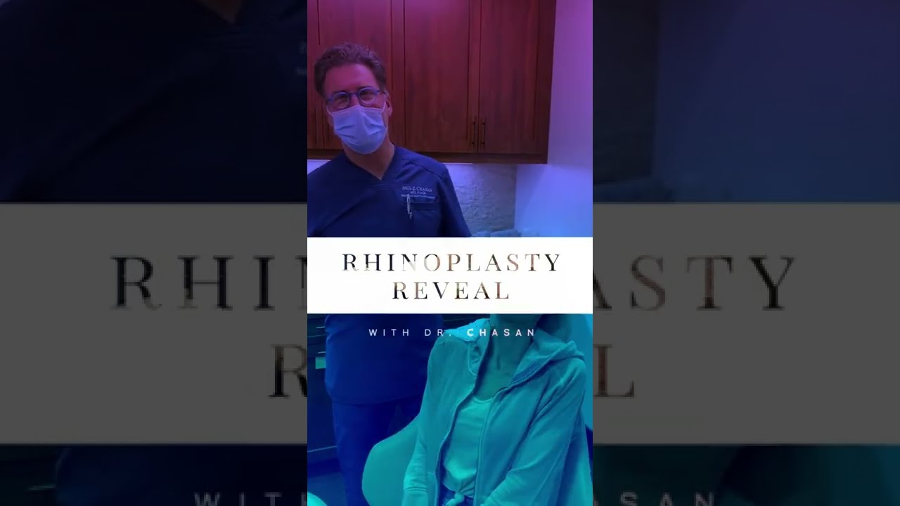 Rhinoplasty Reveal - #13
