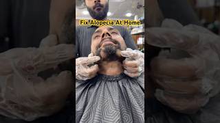 Solution For Alopecia - At Home
