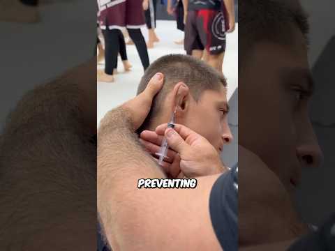 Why Fighters Get Their EARS Drained… #xs28