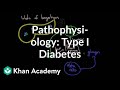 Exploring Pathophysiology of Type I Diabetes