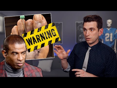 Doctor Reacts to Deion Sanders AMPUTATION - Coach Prime Barstool Sports