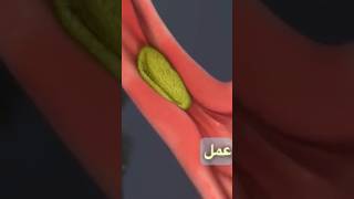 اسفنکتر تهتانی، این دریچه بعنوان یک دروازه یک طرفه عمل می‌کند #اسید_معده #رفلکس_معده