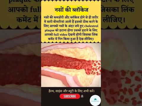 नसों की कमज़ोरी और ब्लॉकेज। #shorts #viral #health