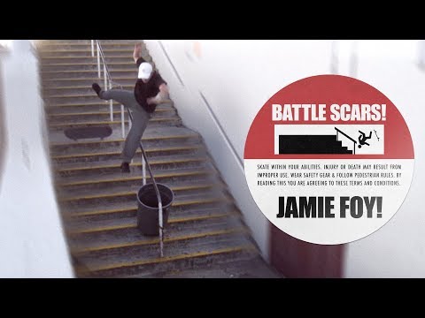 Jamie Foy's Battle Scars