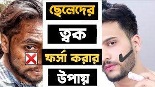 রাত্রে শোবার আগে 2 ফোটা লাগিয়েনিন সকালে মুখ এতো উজ্জ্বল হবে যে লোক অবাক হয়ে যাবে