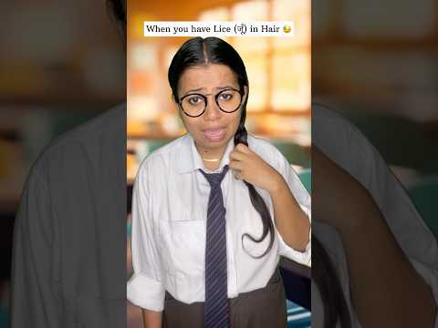 When you have Lice (जूँ) in Hair & everyone makes fun of you😭#sad #schooldays #bad #memories #short