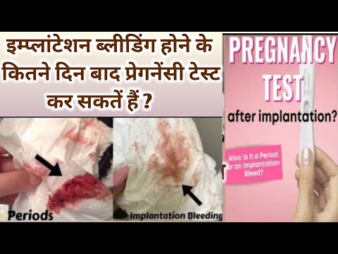 Implantation Bleeding ke baad Pregnancy test kab kare| Early Pregnancy symptoms।Pregnancy Ke Lakshan