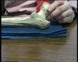 Pressure and Tissue Viability Concepts