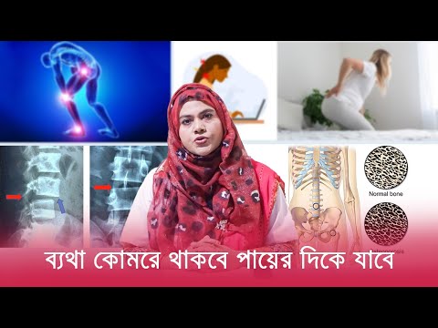 হাড় ক্ষয় নিয়ে ভয় নয়, ব্যথার কারণ জানা জরুরী