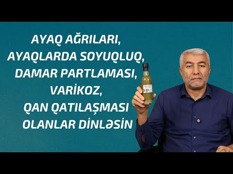 Damar problemləri, Varikozlar, Ayaqlarda damar partlaması olanlar üçün | Fizuli Hüseynov