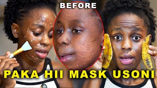 Kuondoa CHUNUSI Usoni na MAKOVU kwa haraka | How to get rid of acne