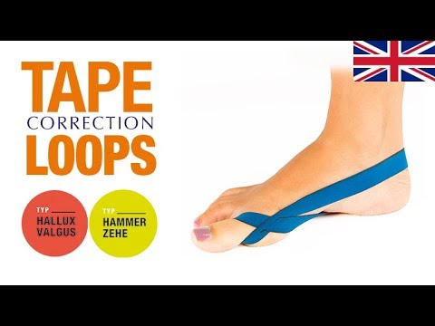 COMPRESSANA TAPE LOOPS - the aid suitable for daily use against hallux valgus and hammer toe
