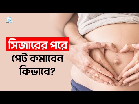 সিজারের পর পেট কমানোর উপায় | সিজারের পর পেট কমাতে যা করবেন | সিজারের পর ডায়েট
