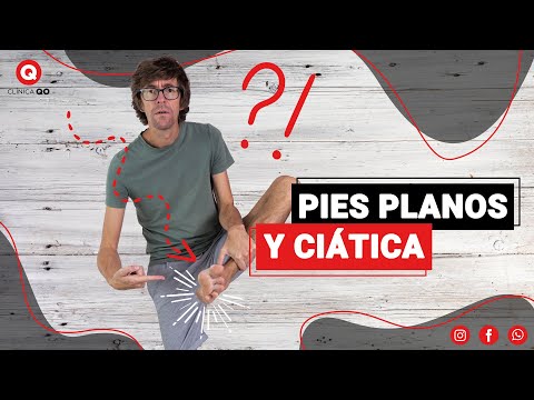 Cómo tus PIES PLANOS pueden causar ciática (¡y qué puedes hacer!)