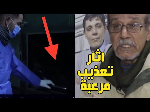 شاهد ماوجدوه علي جـ ـثمان مازن قبل دفنه تفاصيل مرعــبة كشفها شقيقه لاول مرة#مازن_حمادة#مطار_دمشق