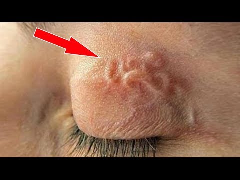 5 СУЩЕСТВ, ОБНАРУЖЕННЫХ ВНУТРИ ЧЕЛОВЕКА
