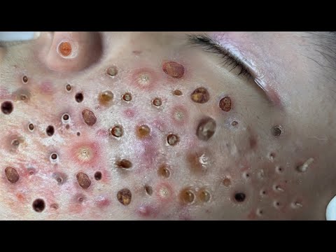 Most Satisfying and Relaxation with An Spa Video #2286