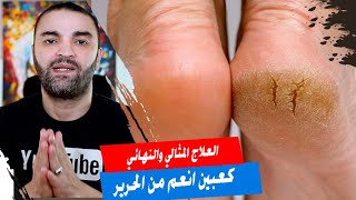 علاج  تشقق الكعبين | كعوب انعم من الحرير وابيض من القشطة
