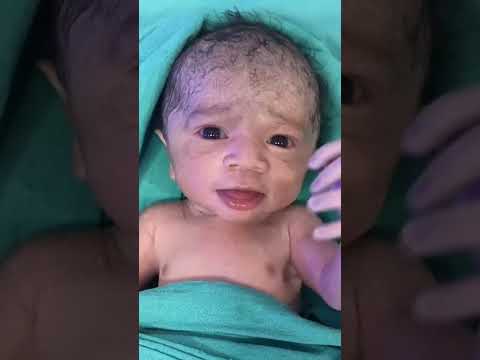 Such a big miracle in such a little baby |#shorts #healthybaby #love #drpoonammaggo