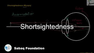 Short-sightedness and its Correction